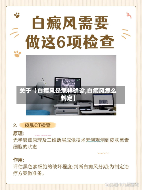 关于【白癜风是怎样确诊,白癜风怎么判定】