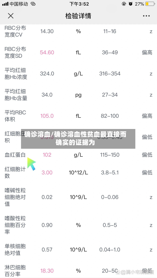 确诊溶血/确诊溶血性贫血最直接而确实的证据为