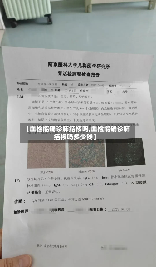 【血检能确诊肺结核吗,血检能确诊肺结核吗多少钱】